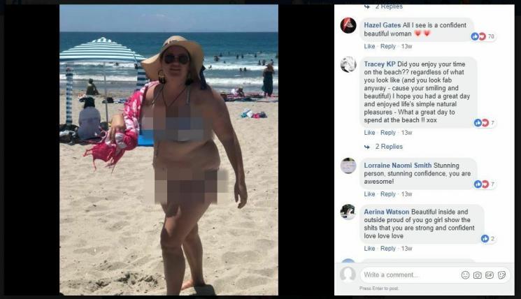 Kena Body Shaming di Pantai, Respons Perempuan Ini Tuai Pujian (facebook.com/Bald and Beautiful)