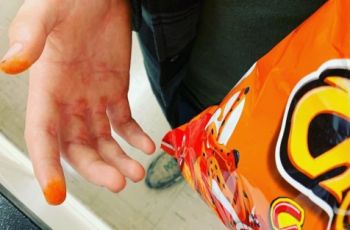Bikin Ketagihan, Ini Nama Resmi Bumbu Cheetos yang Menempel di Jari