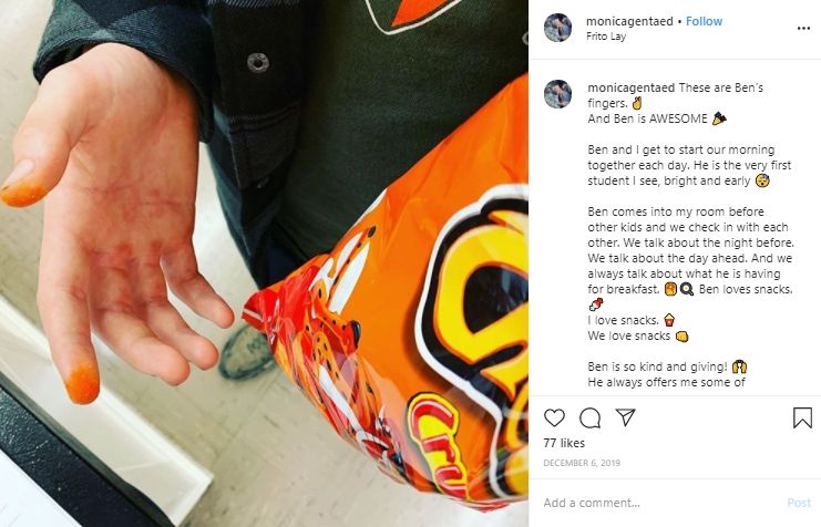 Cheetle, bubuk Cheetos yang menempel di jari. (Instagram/@monicagentaed)